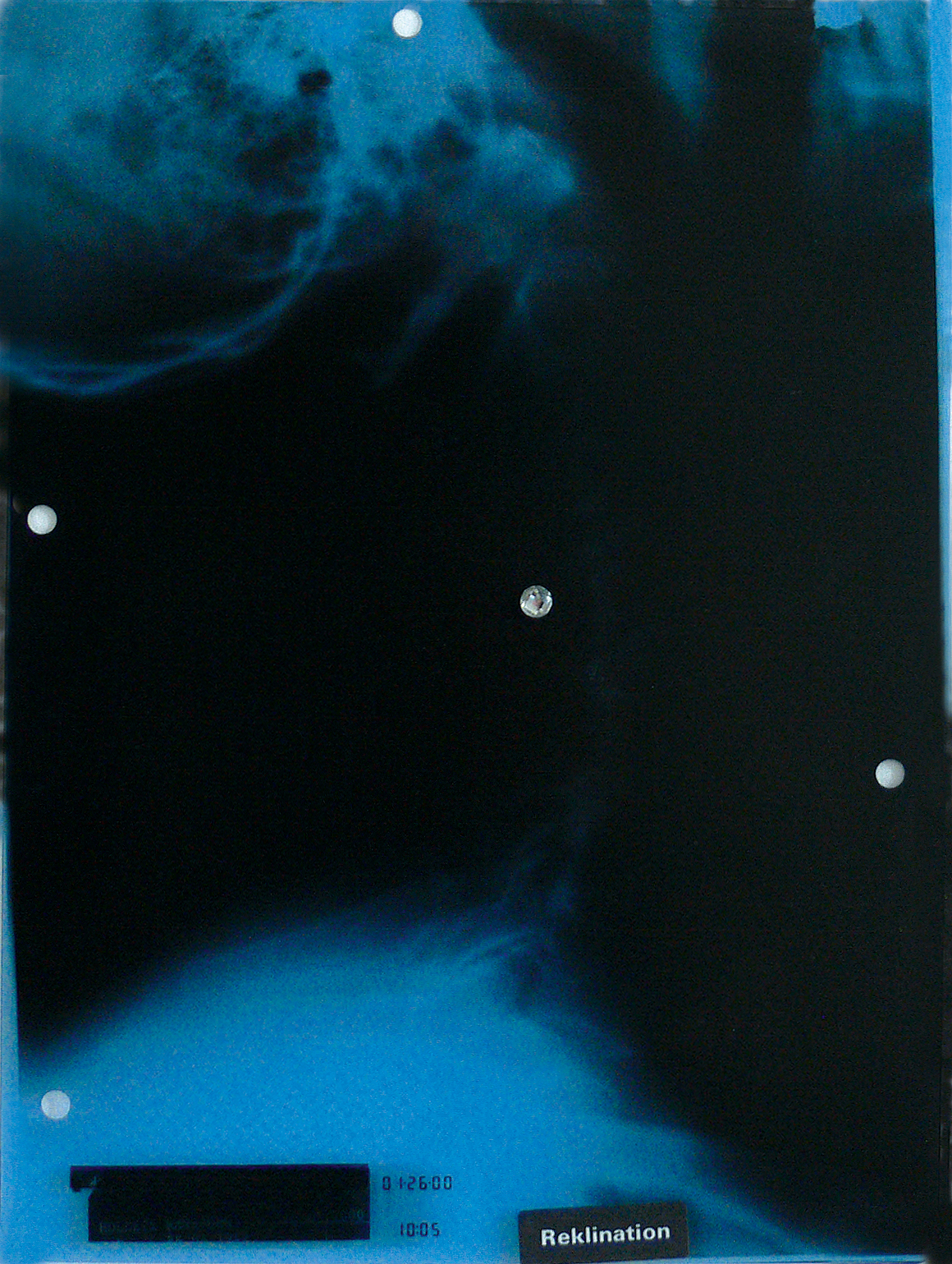 Reclination ? // Röntgenbild auf Papier // Sticker // 21 x 15 cm // 2019